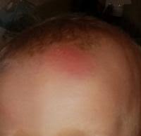 Sie schläft bei mir im doppelbett und ich bin morgens aus dem schlaf geschreckt weil einen plumps gemacht hat und sie dann natürlich richtig arg geweint hat. Hilfe Baby 9 Monate Aus Bett Gefallen Forum Baby Urbia De