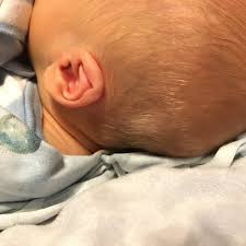 This is the adorable name she's dubbed the whitest of platinum blonde dye surprisingly, jewel says the overall process of creating baby white hair isn't particularly hard, as long. Random Patch Of White Hair Babycenter