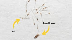 Image result for lice vs nits