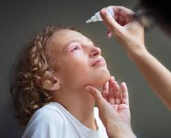 5 loại thuốc nhỏ mắt trị đau mắt đỏ hiệu quả và tốt nhất