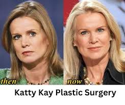 Katty Kay Plastic Surgery