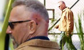 Kevin Costner Sports Nasty Looking Head Injury And A Very Questionable Hairstyle As He Films Terrifying Ambulance Crash Scene On The Set Of Criminal Daily Mail Online