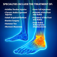 Sportsmed doctors will attempt to move the joint/ body part and check if there is numbness or swelling. Podiatrist Vs Orthopaedist Florida Orthopaedic Institute