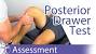 Lachman Test Knee