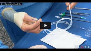 Image result for Intrapleural Anesthesia