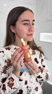 Publi*He documentado mi viaje real de 4 semanas usando este tratamiento de  @Pelo Pantene para la caída del cabello. Constancia, cuidado del cuero  cabelludo y el producto adecuado ✨ Si estás pasando ...