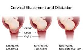 Oh wow that is quick! Cervical Dilation Pregnancy Delivery Labor And Child Delivery Mothersspace