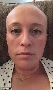 A cancer survivor who lost all her hair to chemo kept a photo diary