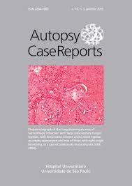 Join wikimd as a freelancer or paid editor and help improve the page appendices epiploicae or others. Autopsy Case Report By Editora Cubo Issuu