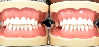 People often choose a private practice if they prefer an increased level of care or are. Dental Costs Taking Too Big A Bite Otago Daily Times Online News