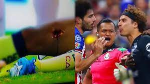 Después de dos años se terminó la relación del américa con el jugador giovani dos santos. Imagenes Fuertes Aterradora Lesion De Giovani Dos Santos Tras Entrada De Briseno El Grafico Historias Y Noticias En Un Solo Lugar