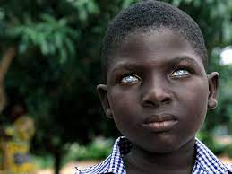This is where males and females choose as their mates those who have one unusual physical characteristic, not necessarily associated with fitness per se but simply something unusual. The Truth Behind Black Africans With Blue Eyes
