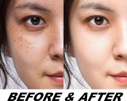Photo Editing, Face Retouch, Natural Skin Retouching, Portrait Retouch,  Professional Headshot Editing