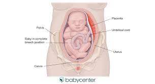 Malaysia home & garden, malaysia baby supplies & products, malaysia household sundries Breech Position And What It Means For Labor And Delivery Babycenter