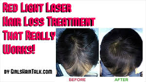 Here are the best laser therapy for hair loss treatment. Laser Treatment For Hair Loss Tips For Faster Regrowth