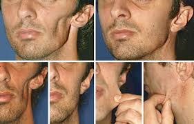 A Practical Guide to Wound Healing