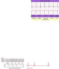 A v r t 4. Interpretasi Ekg