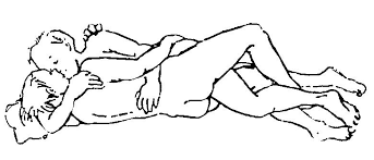 I mange tilfeller kan i noen tilfelle kan man også oppleve smerter på natten, spesielt når man ligger på den involverte siden. Samlejestillinger Efter Hofteoperation Regionshospitalet Viborg Hospitalsenhed Midt