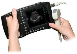 Аппарат ультразвуковой диагностический цифровой AcuVista RS880b, Shenzhen Well. D Medical Electronics Co., Ltd., Китай