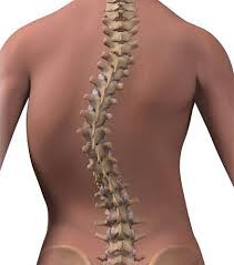 If you want to learn tulang belakang in english, you will find the translation here, along with other translations from indonesian to english. Physiogo Amaran Tulang Belakang Bengkok Scoliosis Facebook