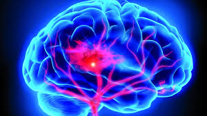 El gran problema del aneurisma es el riesgo de ruptura y pérdida masiva de sangre. Aneurisma Cerebral Neurologista Leandro Teles