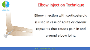 Image result for Elbow Joint Injection