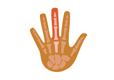 Middle Knuckle Pain in the Finger | Causes and Treatments | Buoy