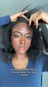 Hair Growth Journey using Clove and Rosemary Water