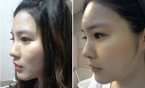 试试 使用pc客户端播放更稳定 立即下载 返回继续播放 或使用最新 qq浏览器 / chrome观看 [ 错误码: æ•™ä½ ä¸€ç§'è­˜ç ´æ•´å½¢è‡‰ é¼»æ¢çœŸå‡çœ‹çœ¼çª© éµç›¤å¤§æª¸æª¬ Ettodayæ–°èžé›²