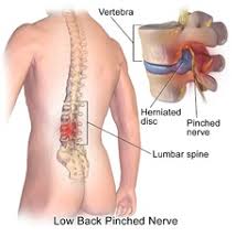 Loin pain lumbago nos excludes1: 847 2 Icd 9 10 Dx Sprain Lumbar Region Code For Chiropractor Medical Billing And Coding Online