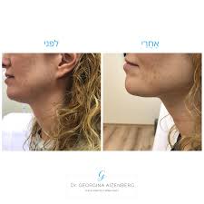 Dr. Georgina Aizenberg רפואה אסתטית בהתאמה אישית