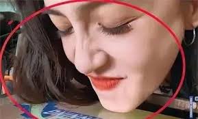 Diệp Kha thẳng thừng thừa nhận dao kéo 40%, cư dân mạng: Huỳnh Hiểu Minh có  'gu' hẹn hò thật lạ!