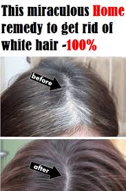 This Miraculous Home Remedy To Get Rid Of White Hair 100 Grey Hair Home Remedies Grey Hair Remedies Remedy For White Hair