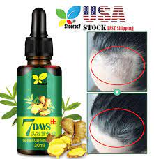 Regrow hair as fast as 7 days! Hair Regrow 7 Day Hair Growth Essence Stcorps7 Ginger Germinal Essential Oil Hair Growth Hair Loss Treatment Hair Care Hair Growth Serum For Men Women Buy Online In Saint Vincent And