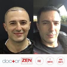 Amazing Team Amazing Results Sac Zen