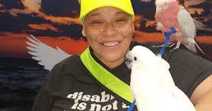 After amputation, losing more of her leg was the only way to help her walk  again