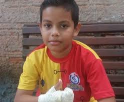 Menino de 9 anos se queima ao ajudar a mãe a apagar fogo na casa de vizinha  com deficiência em MT