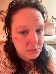 Please join me in welcoming our newest members! 💪 We are a community of  individuals united by the shared experience of bipolar disorder, connecting  and supporting each other across the globe. 🌎 **