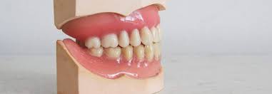 What is the price of full set of dentures? What Are Dentures And How Do They Work Revitalise Dental Centre