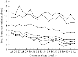 Computerized Analysis Of Normal Fetal Heart Rate Pattern Throughout Gestation Serra 2009 Ultrasound In Obstetrics Amp Gynecology Wiley Online Library