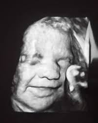 Joe Catanzaro (@nykilnguy) • Instagram photos and videos