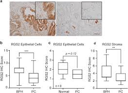 Analysis Of Regulator Of G Protein Signalling 2 Rgs2