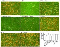 Materiale juridice (stiri, jurisprudenta, legislatie, articole juridice) cu privire la subiectul hg 268/2007. Heat Shock Protein 90 Akt Pathway Participates In The Cardioprotective Effect Of Exogenous Hydrogen Sulfide Against High Glucose Induced Injury To H9c2 Cells Corrigendum In 10 3892 Ijmm 2018 3708