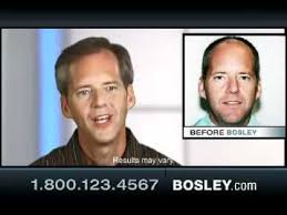 Does Bosley Really Work Does It Really Work