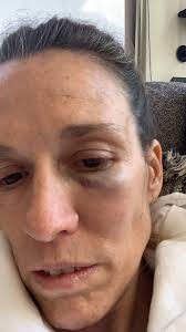Find the perfect arturo alfonso gonzalez gonzalez stock photos and editorial news pictures from getty images. Arturo Gonzalez Orduno Ø¹Ù„Ù‰ ØªÙˆÙŠØªØ± Denuncielo Es Rolando F Tiene 45 Anos Ha Sido Identificado Como Artista Plastico Y Visual Y Es Buscado Por Golpear A Una Mujer Que Corria En Parque