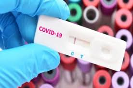 Hasil Rapid Test Reaktif Tiga Warga Kkt Ditahan Siwalima