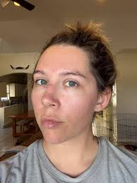 hello, i have a question. i have a oily/dry face and i wanted to know what  kinds of face wash everyone uses to help with acne or prevent it, thank  you! |