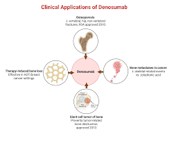 Image result for Denosumab