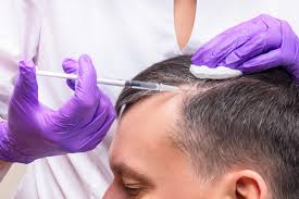 Platelet-Rich Plasma (PRP) Therapy