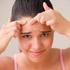 6 Easy Methods To Remove Acne Womens Health Magazine How To Get Rid Of Acne Workout Motivation Women